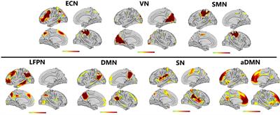 Assessing Cognitive Abilities of Patients With Shift Work Disorder: Insights From RBANS and Granger Causality Connections Among Resting-State Networks